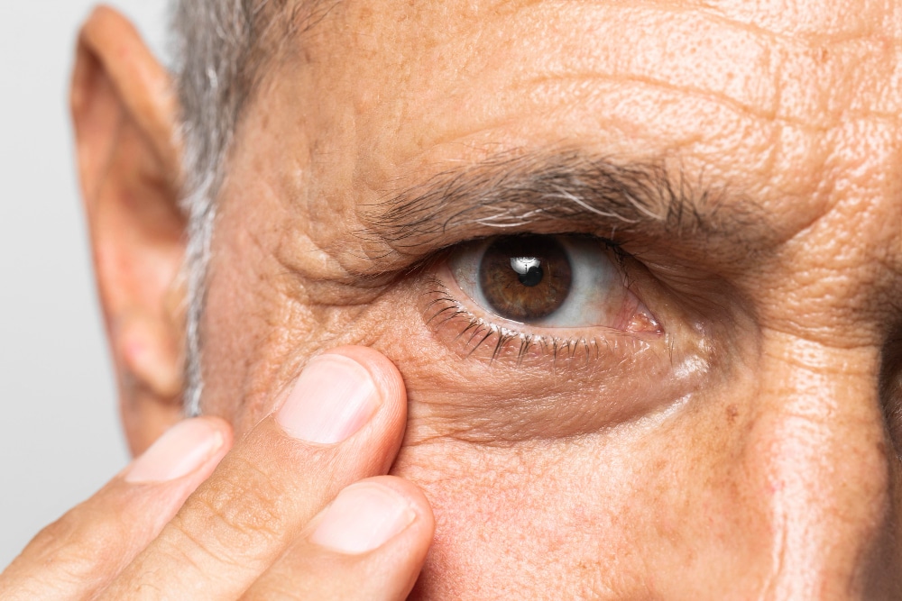 Glaucoma y ceguera irreversible