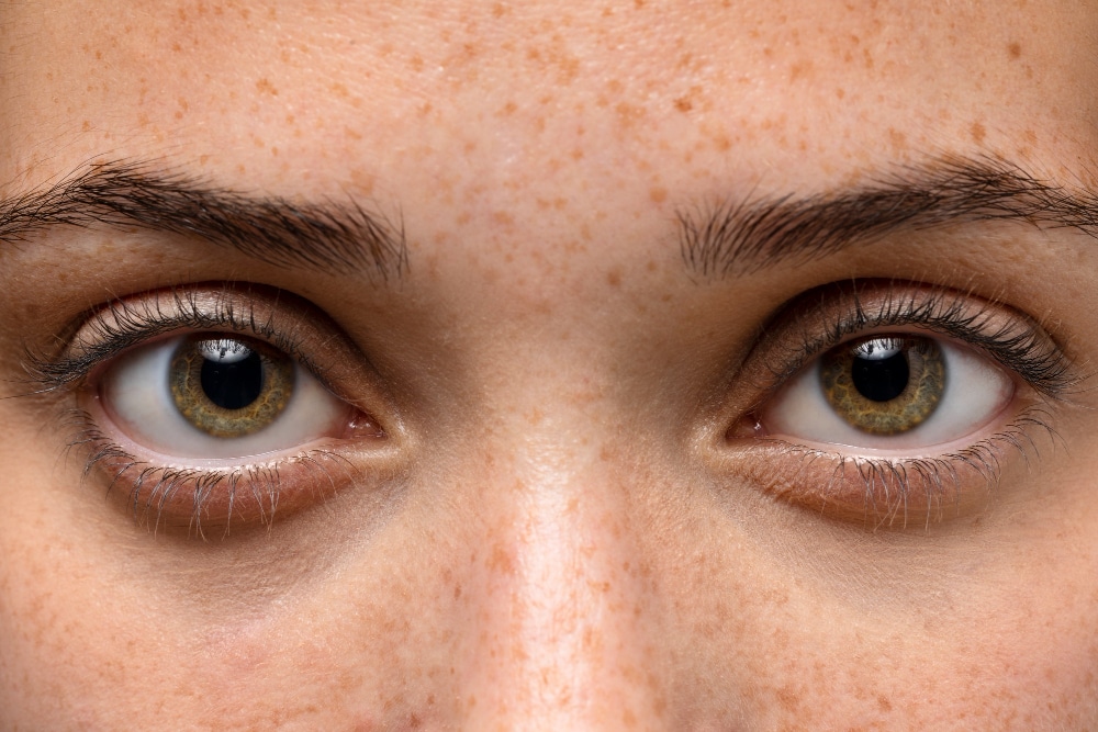 Qué es la retinopatía diabética